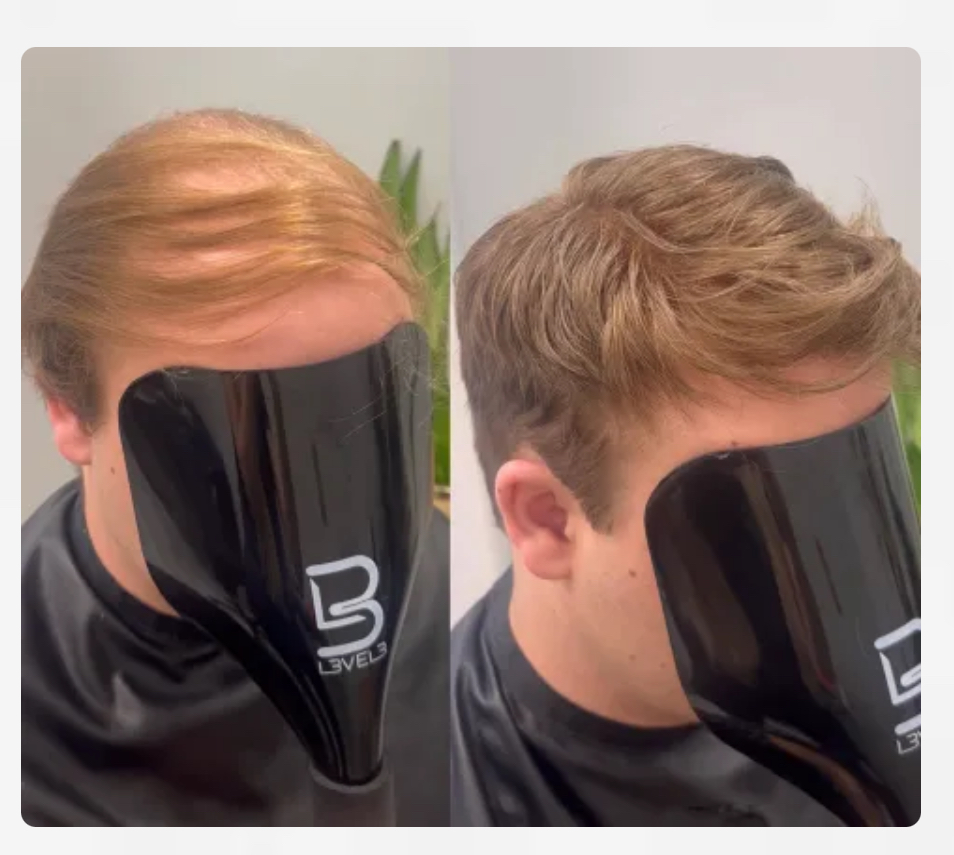 Hair system consultation