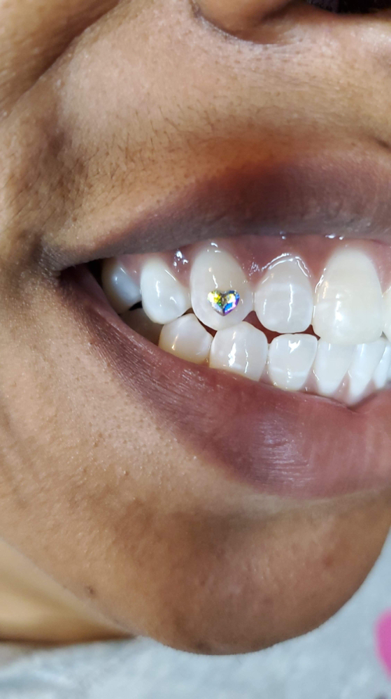 Tooth Gems