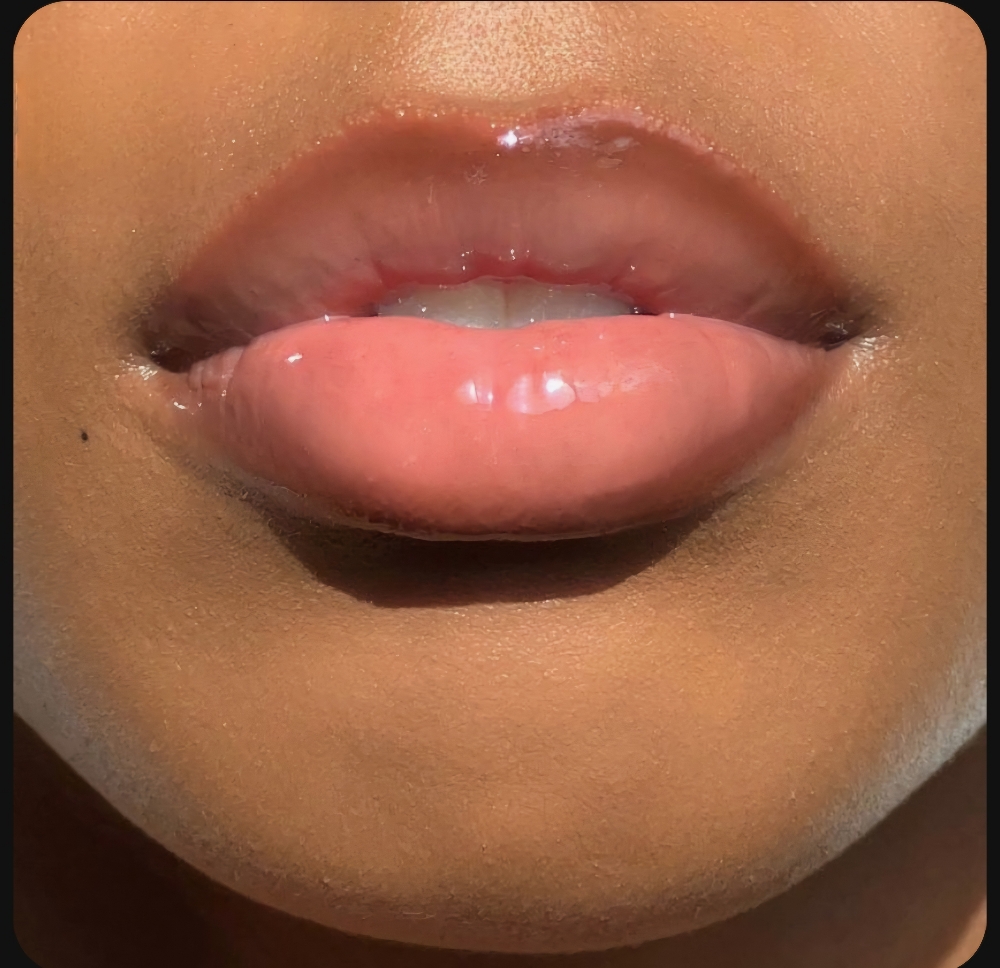 Lip Treatment