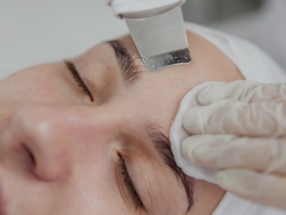 Ultrasonic Exfoliation Add On