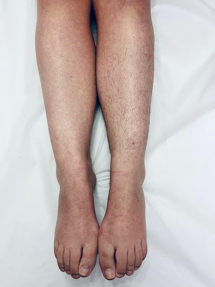 Half Leg