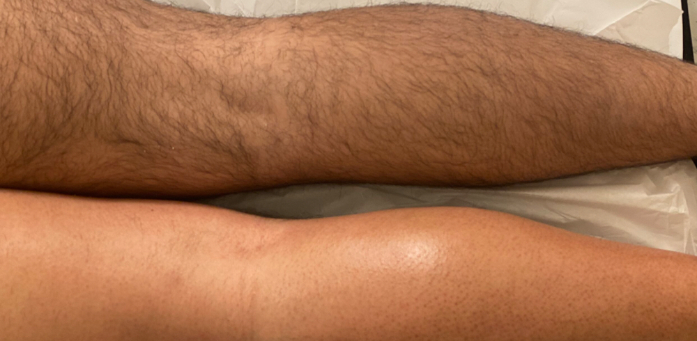 Half A Leg Wax