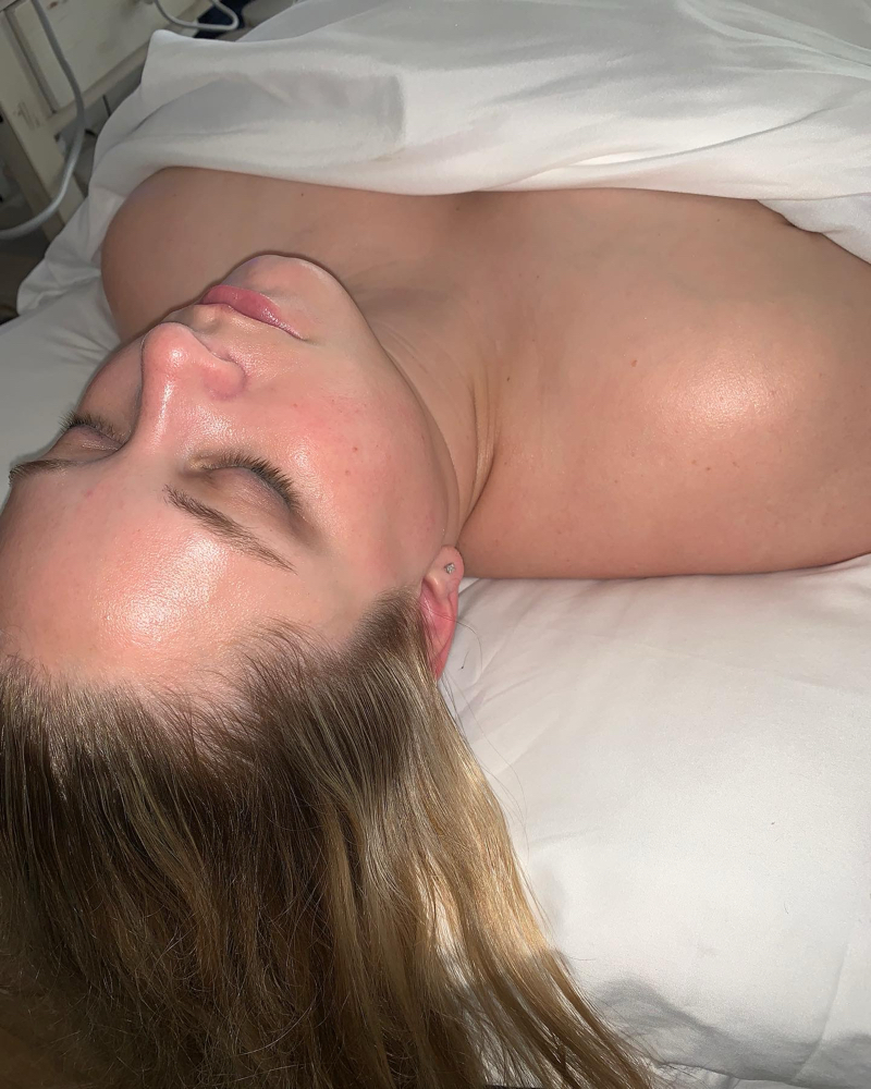 After Sun Facial