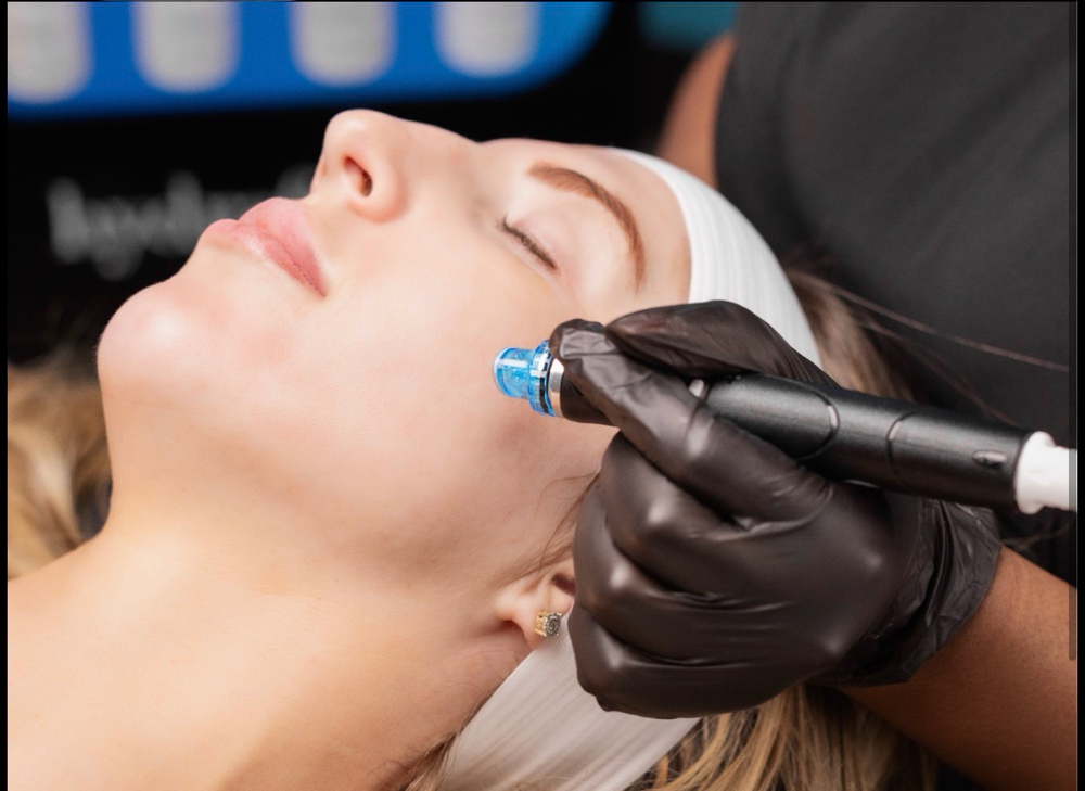 Signature Hydrafacial at BioBeautyAesthetics in Roseville, CA