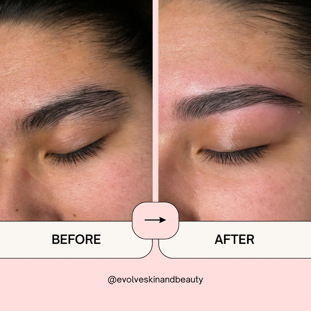 Brow Wax at Evolve Skin And Beauty in San Diego, CA