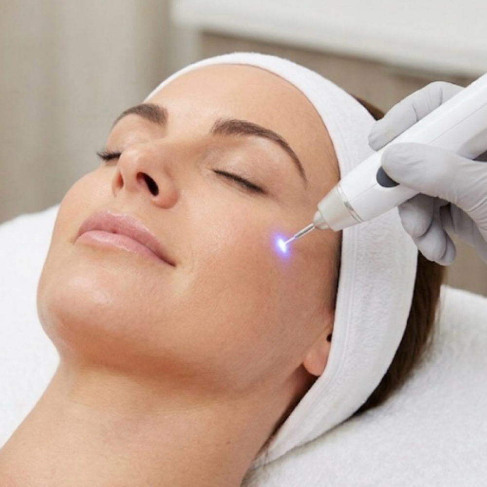 Jet Plasma Add-on at Ann Jay Skin & Body in Clifton, NJ
