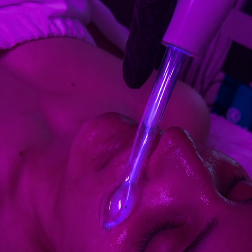 High Frequency-Treats Acne/ingrowns at FacebyMeriee in Williamsville, NY