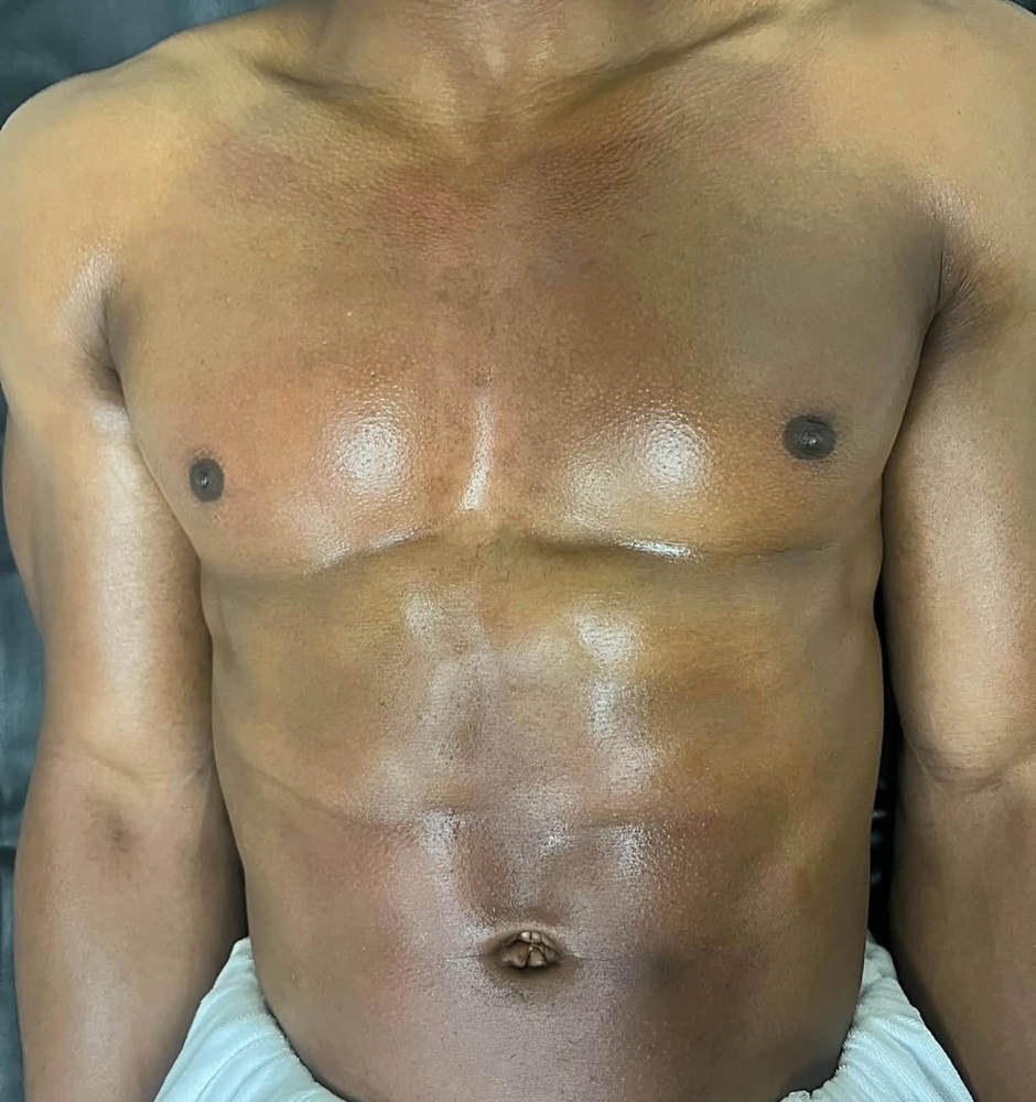 Full Chest (Sugar/Hard Wax)