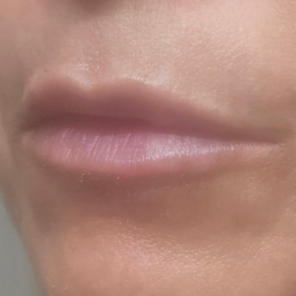 Lip Flip at Pure Bliss Studios in Fort worth, TX