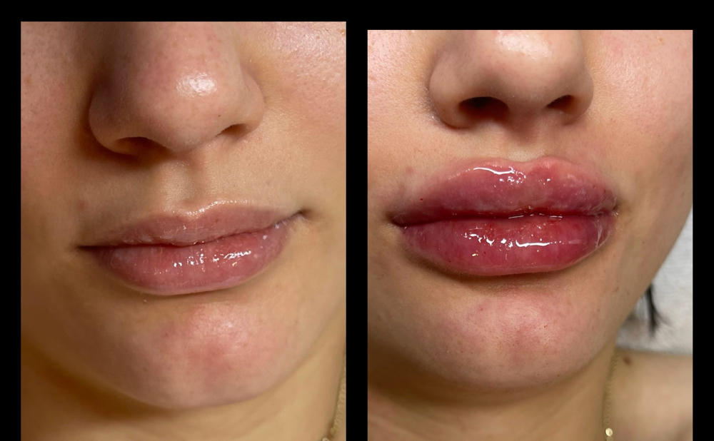 HidrataLip at D&K Beauty&Spa in Newpor News, VA