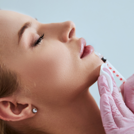 INJECTABLE - Lip Flip at DM Laser Skin Care Solutions in Needham, MA
