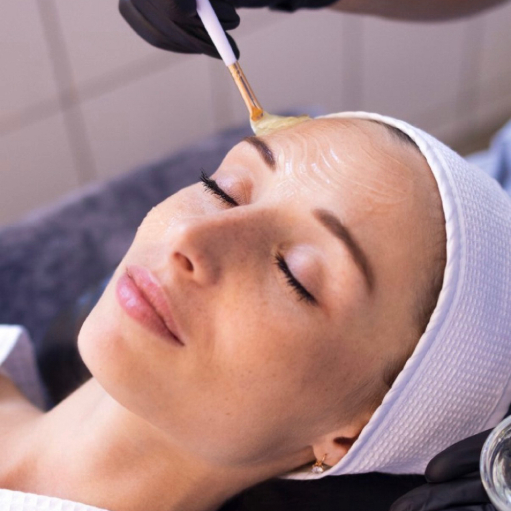 Chemical Peel at Skin Care by Luisa in Missouri City, TX