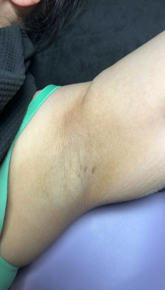 Underarm Wax at Luz Esthetics in Milwaukee, WI