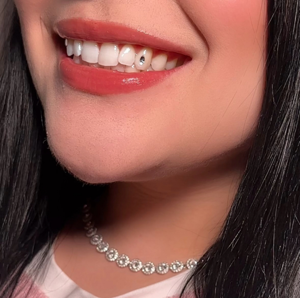 Tooth Gem (1 Single Crystal) at Beauty by MSG in Des Plaines, IL