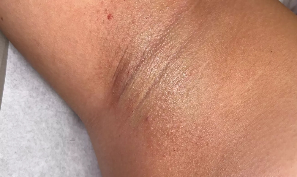 Under Arms