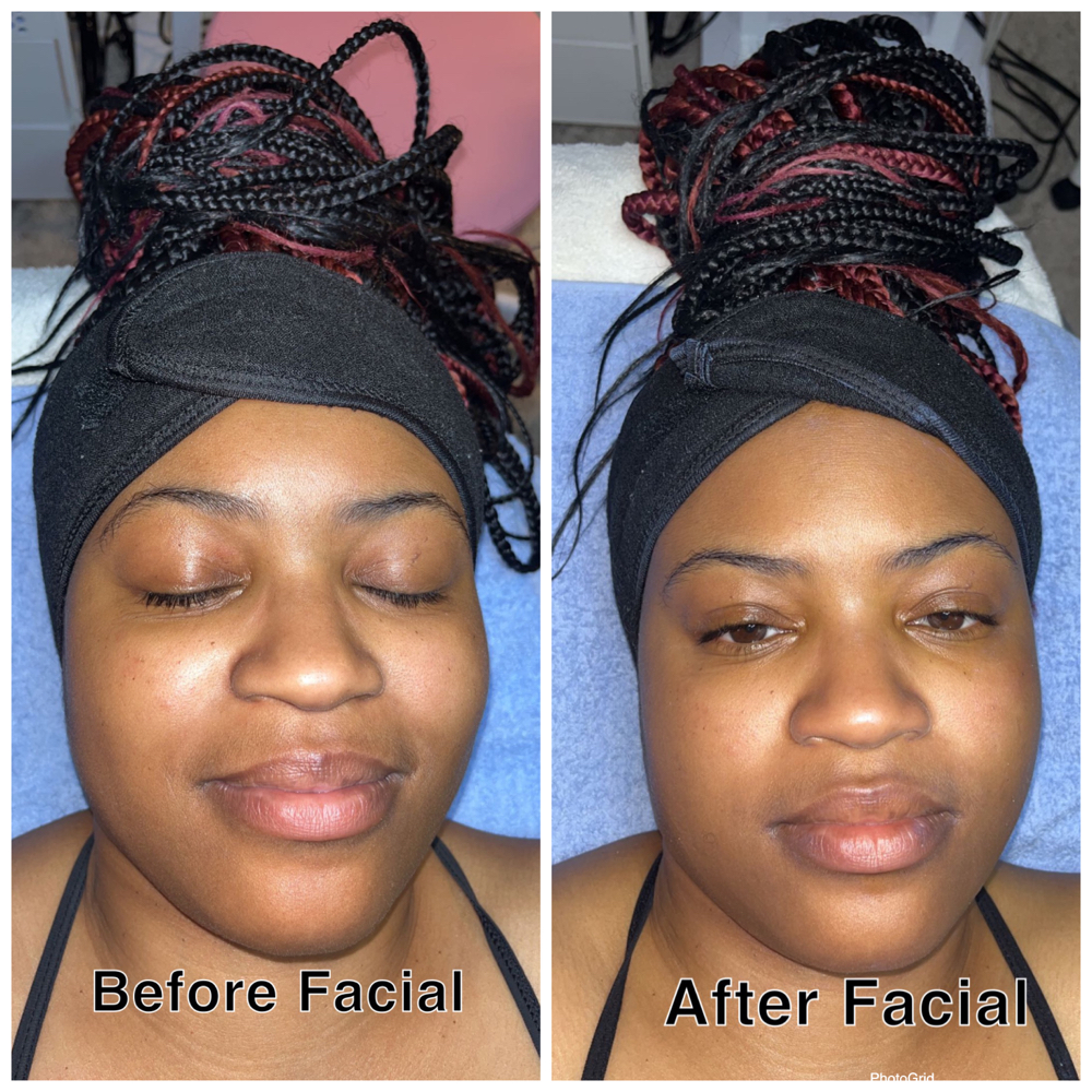 Customized Basic Facial