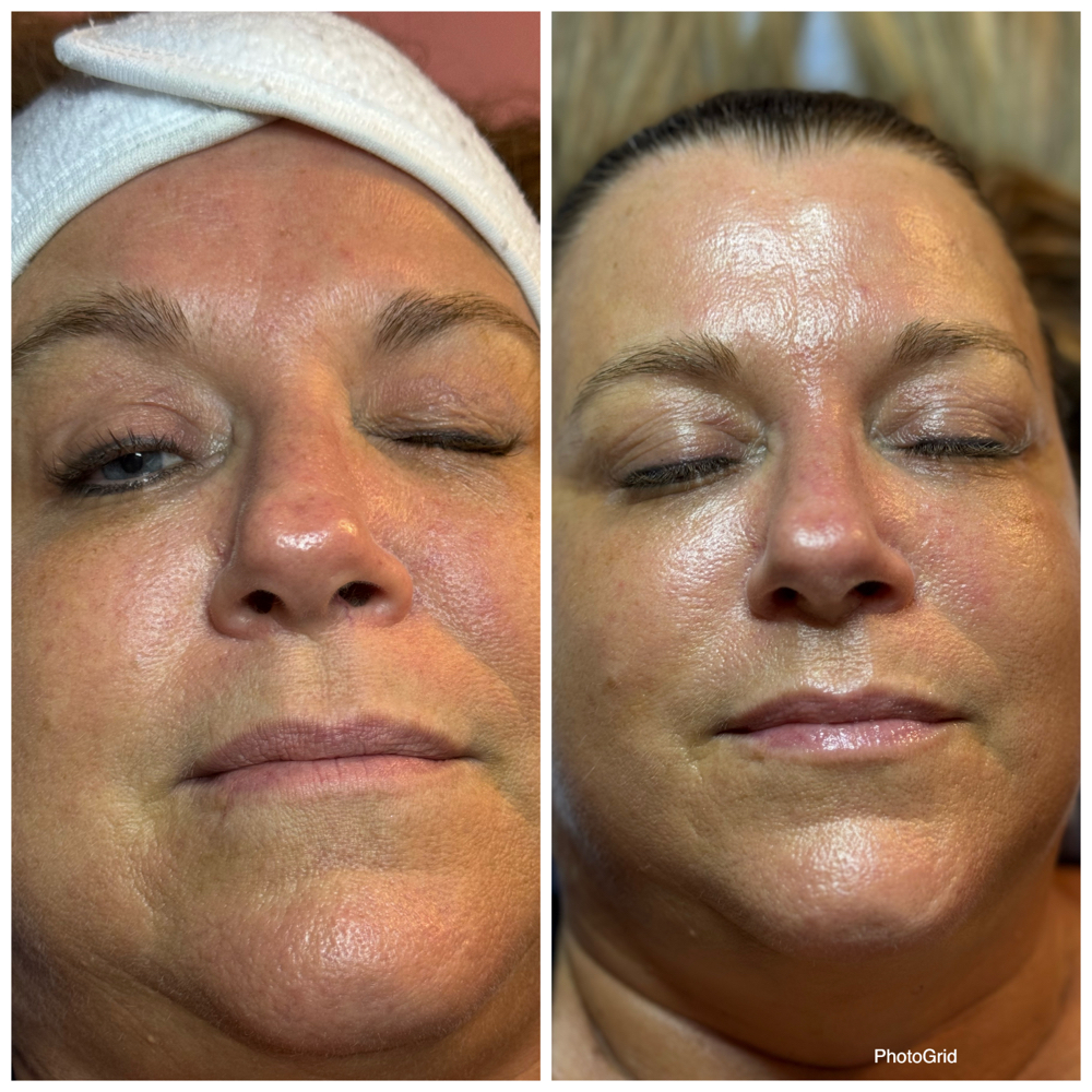 Customized Basic Facial