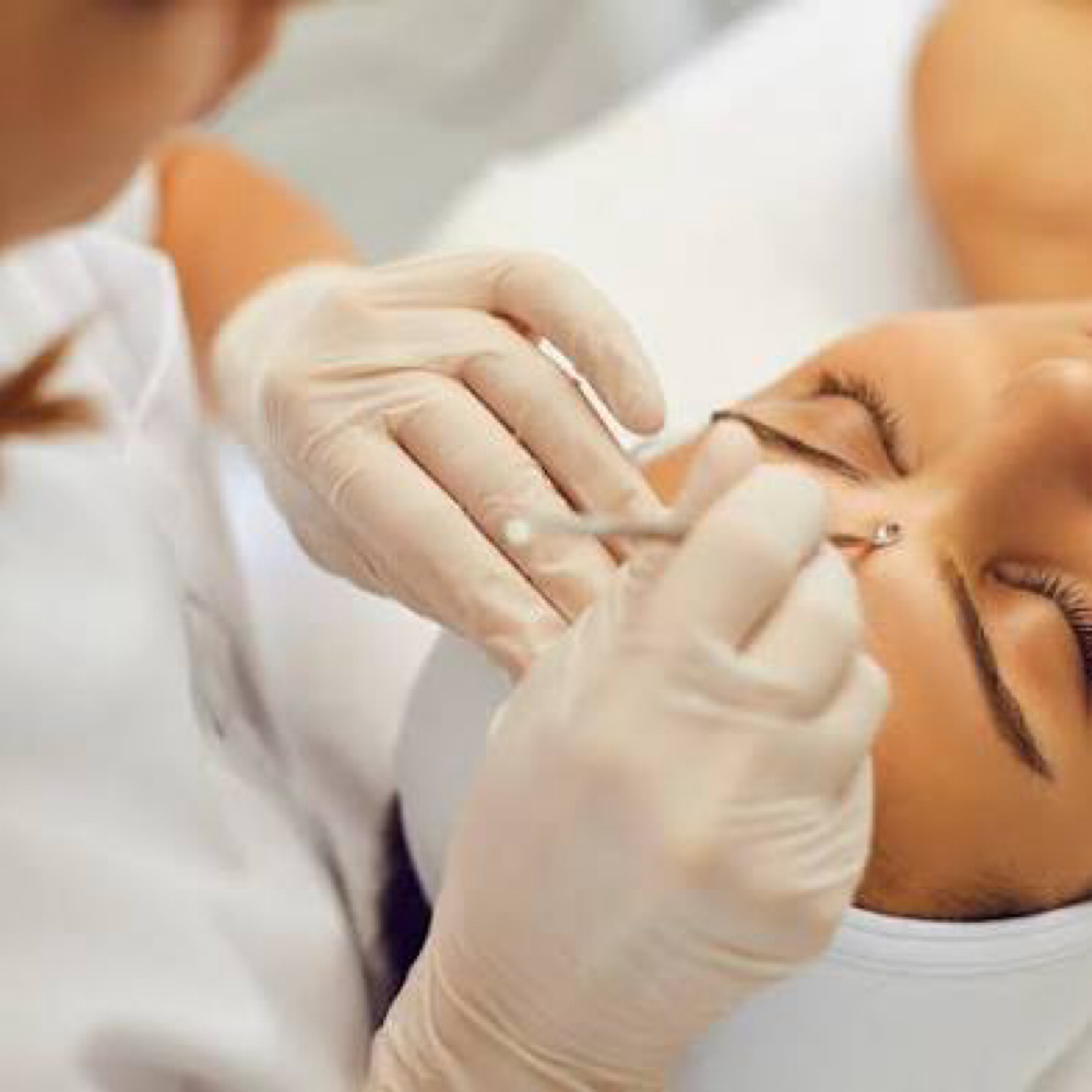Clarifying Acne Facial at MKD Aesthetics in Surprise, AZ