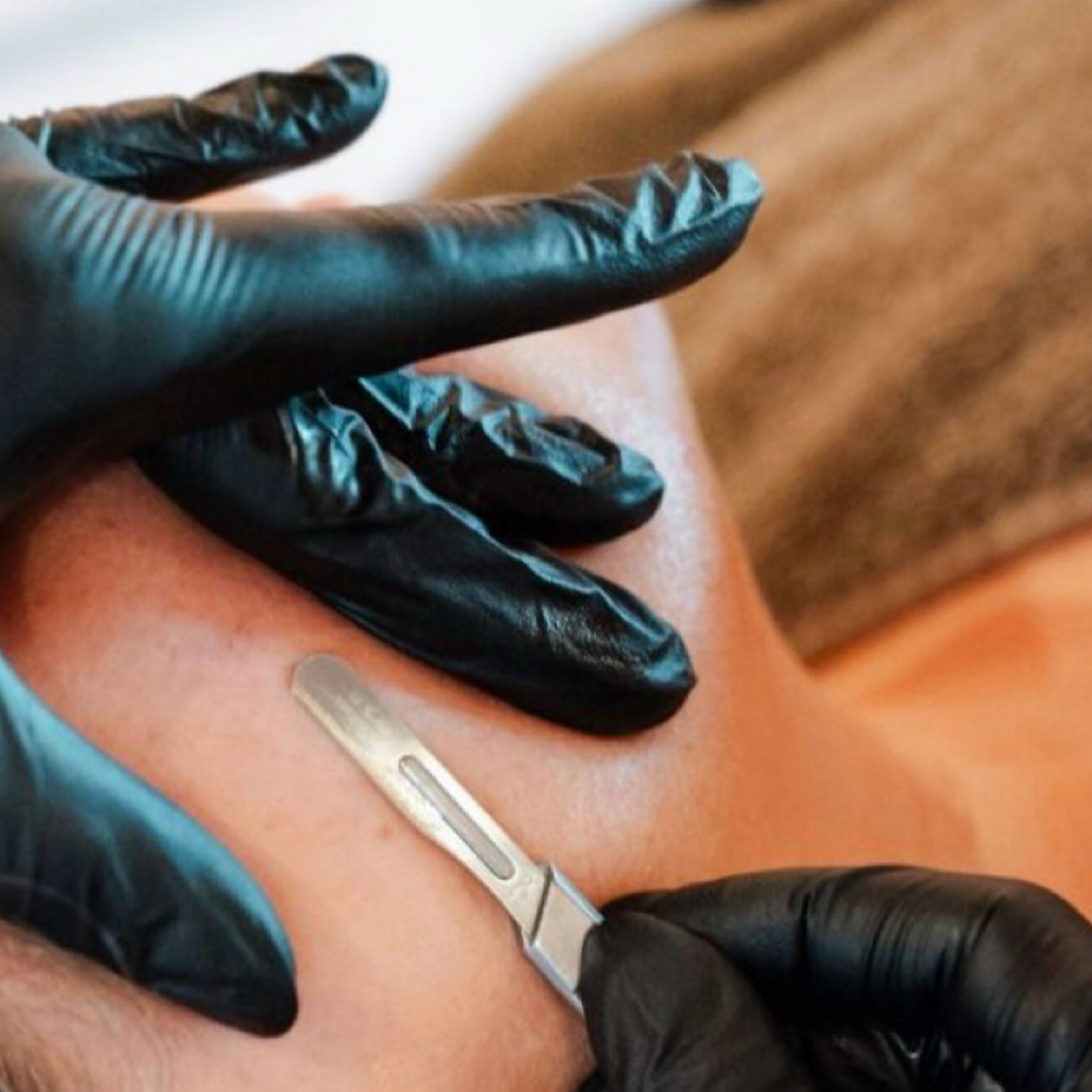 Dermaplane Facial at Esthetics by Skylin in Pensacola, FL