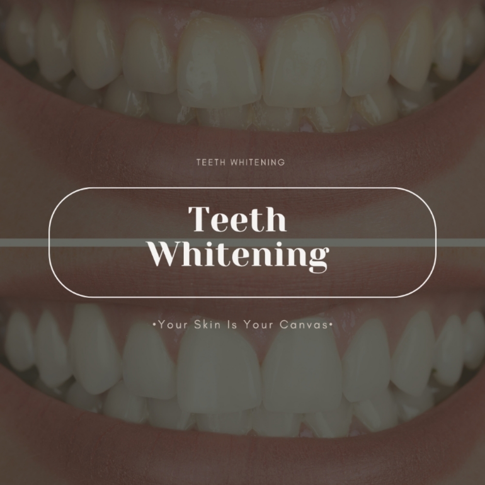 Teeth Whitening at Face Palette Aesthetics in Franklin, WI
