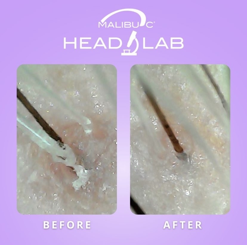 Scalp Detox With Malibu C Head Lab