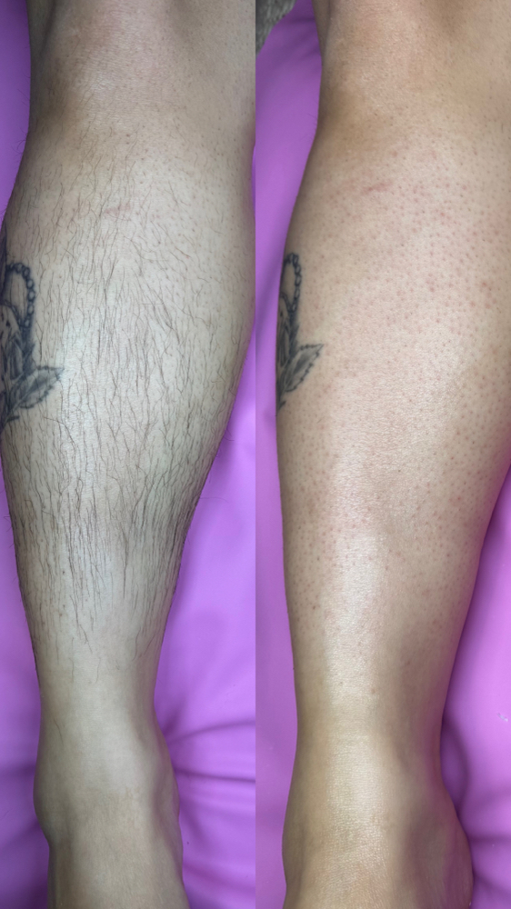 Half Leg Wax - Knee To Ankle