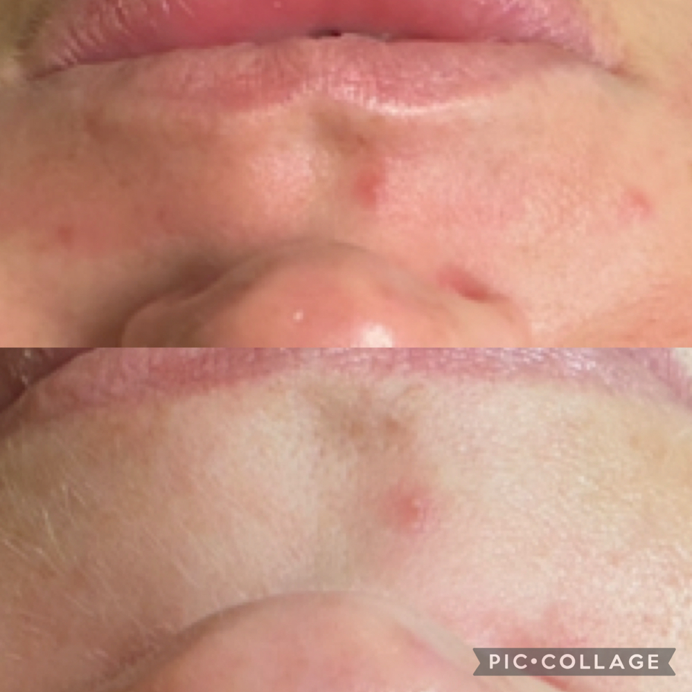 Lip Wax