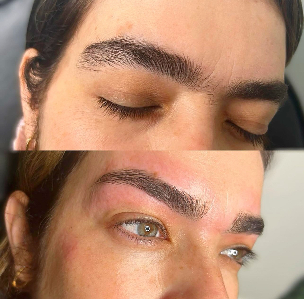 Brows Hair Removal