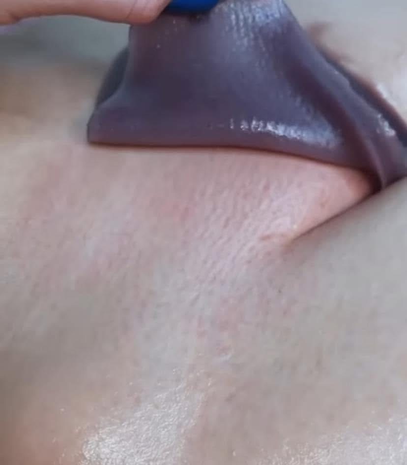 BROjacial