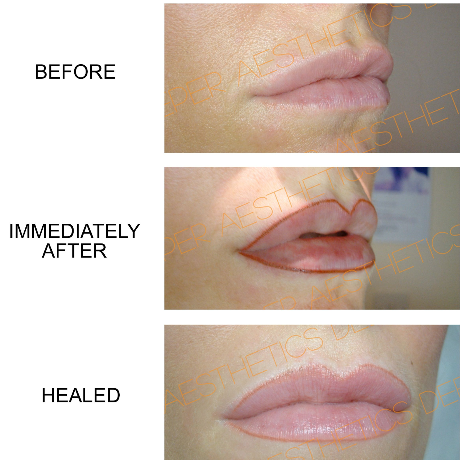 Permanent Lip Blush- (Liner) at Simply Elegant by Carrie in Portland, IN