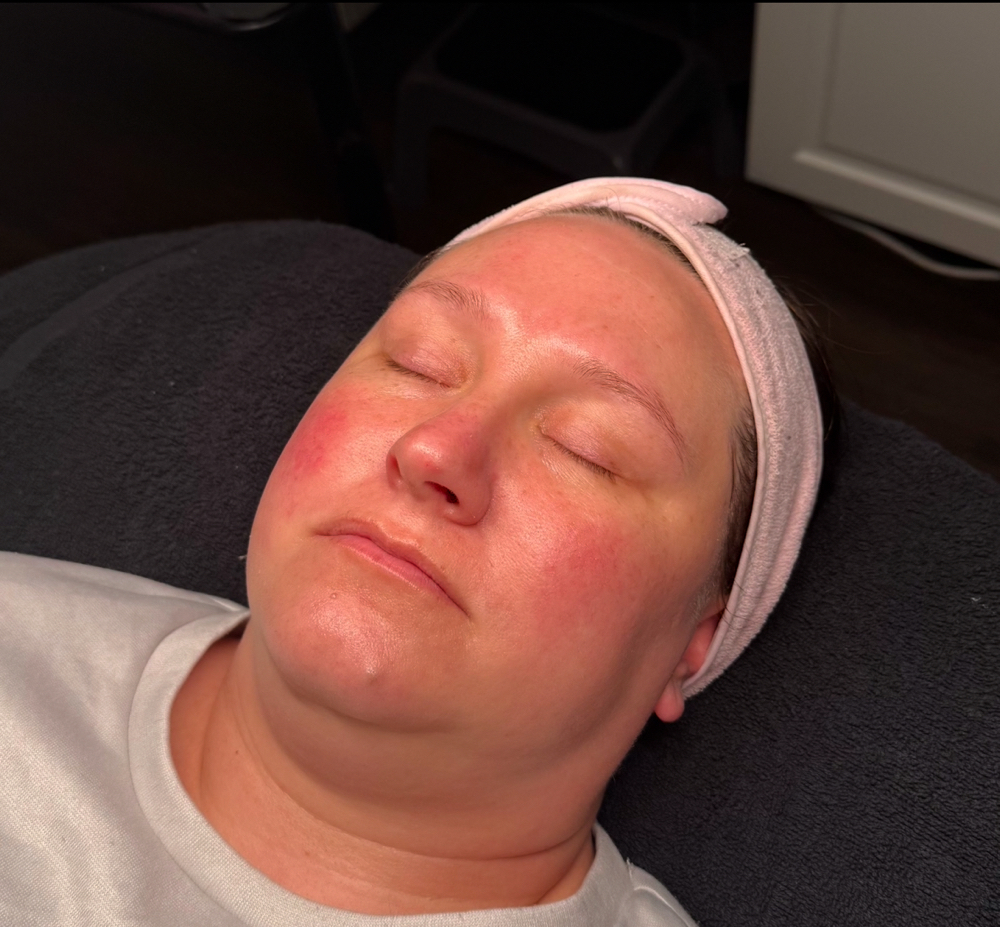 Custom Facial