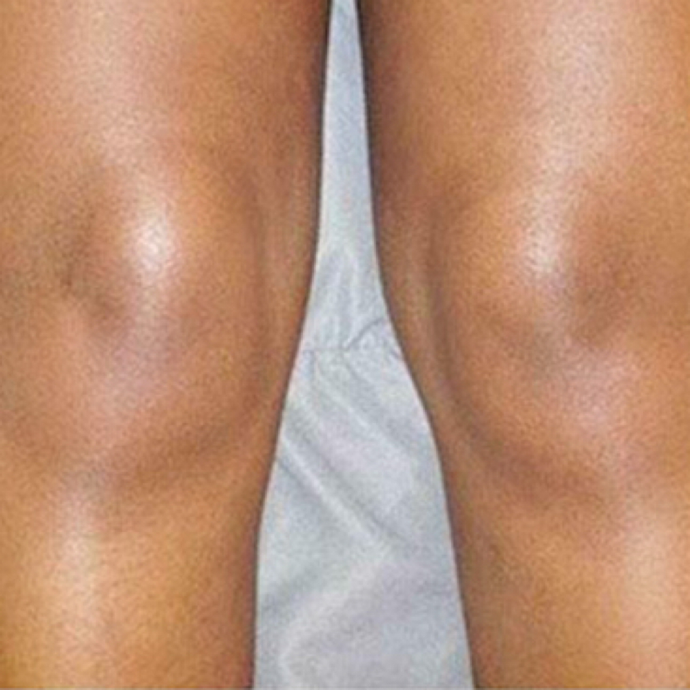 Knee Skin Lightening at Bare With Me in Upland, CA