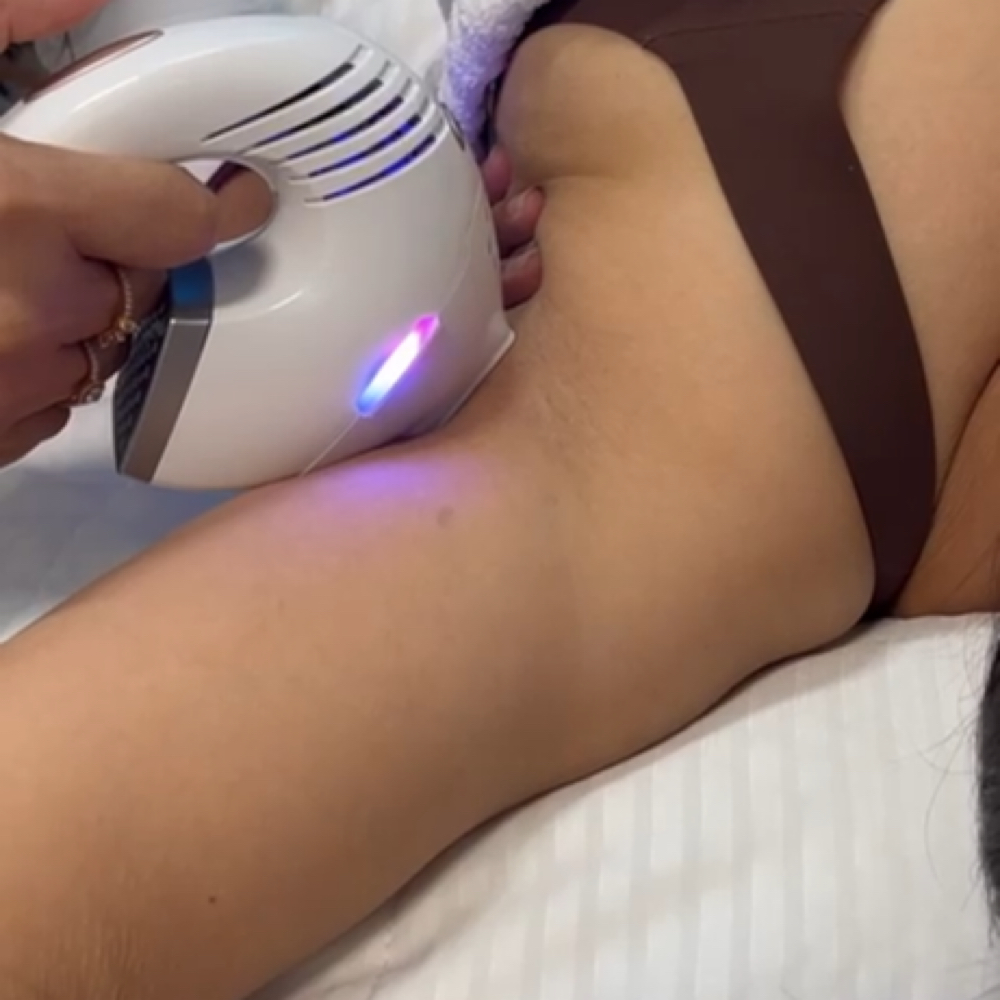 Depilación Laser Axila at Merry Spa in Huntington, NY