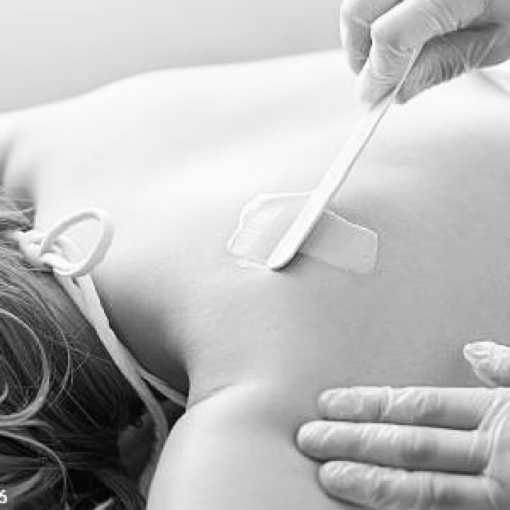 Back Reset - Half at KD Aesthetics in Concord, NC