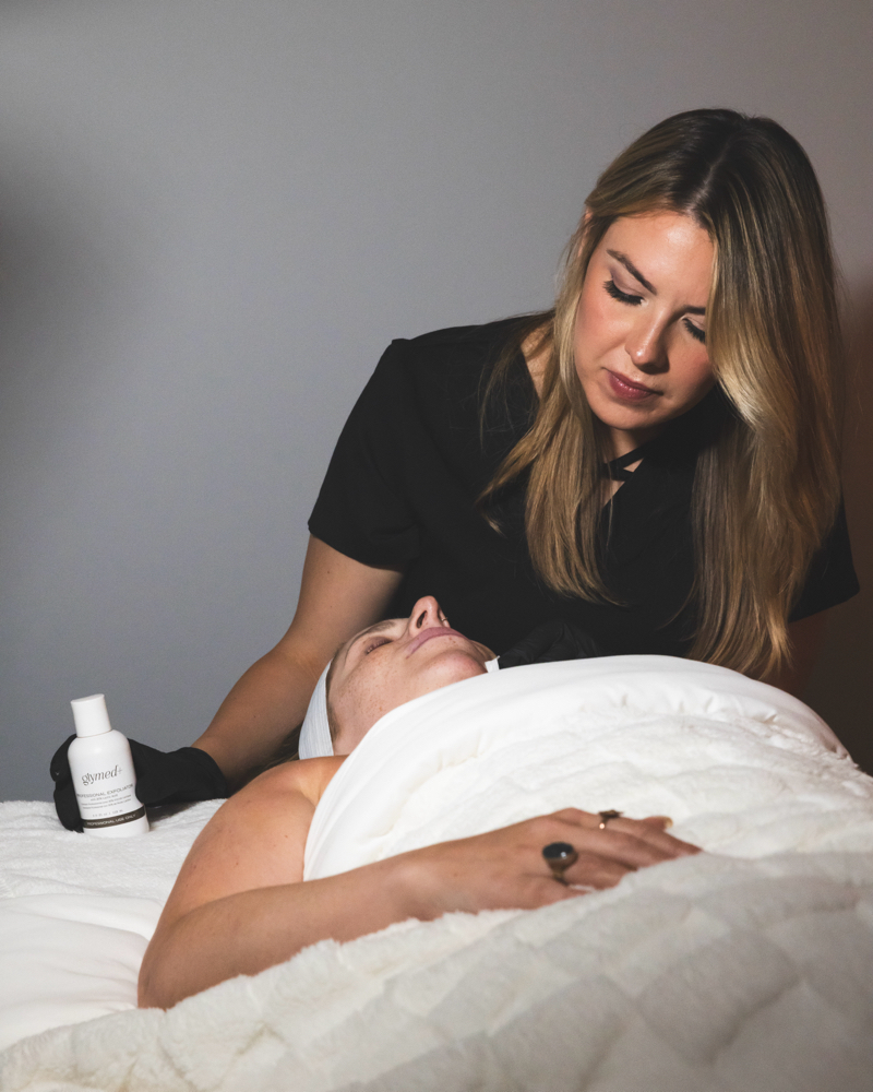 Teen Chemical Peel Add On