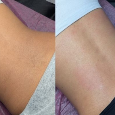 Half Back Wax at Skin by Kay in Orange, CA