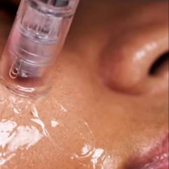 LaRose Custom Nano Infusion at LaRose Skin Studio in Riverside, CA