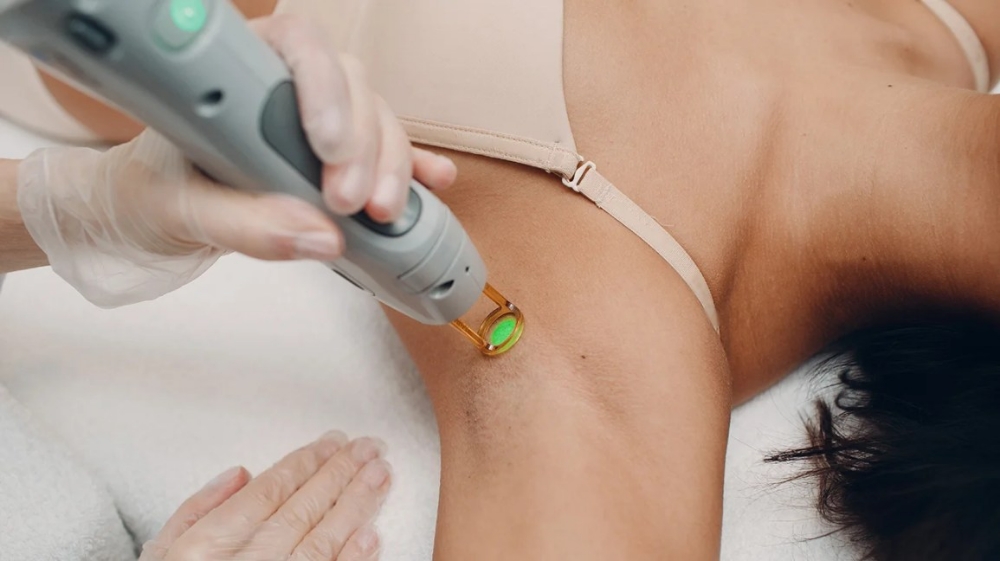Laser Hair Removal (Underarms)