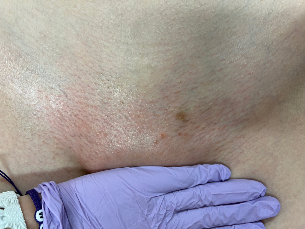 Brazilian Wax