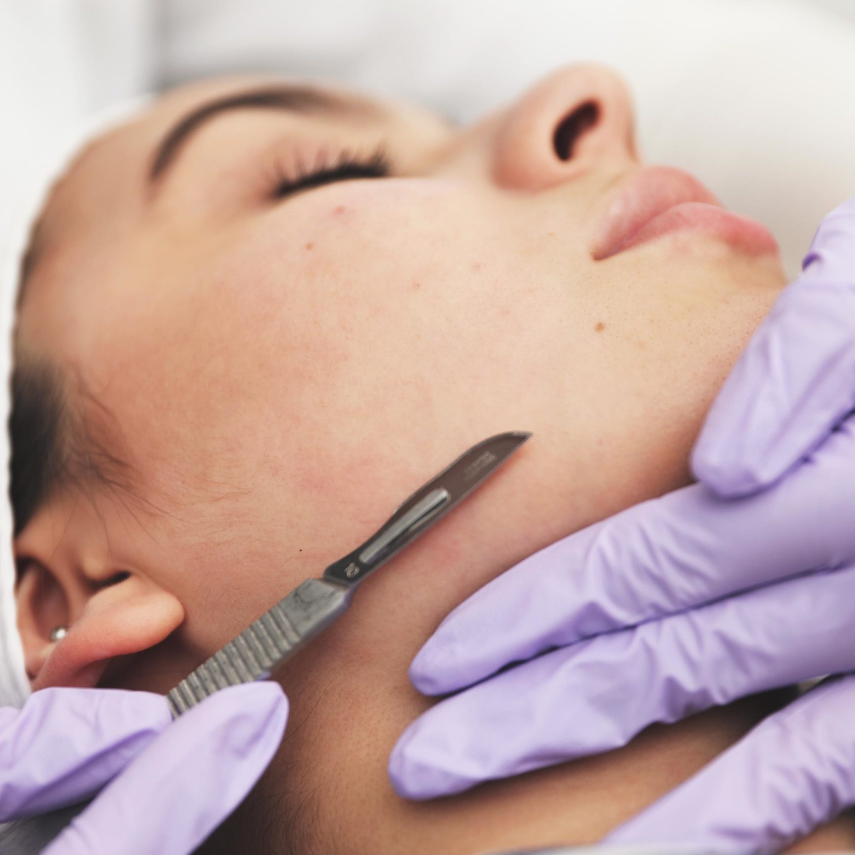 Dermaplane at Milan Salon Spa in El Paso, TX