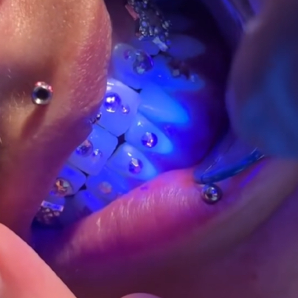 Temporary Tooth Gems at Melt. The Body Bar in Lakewood, CO