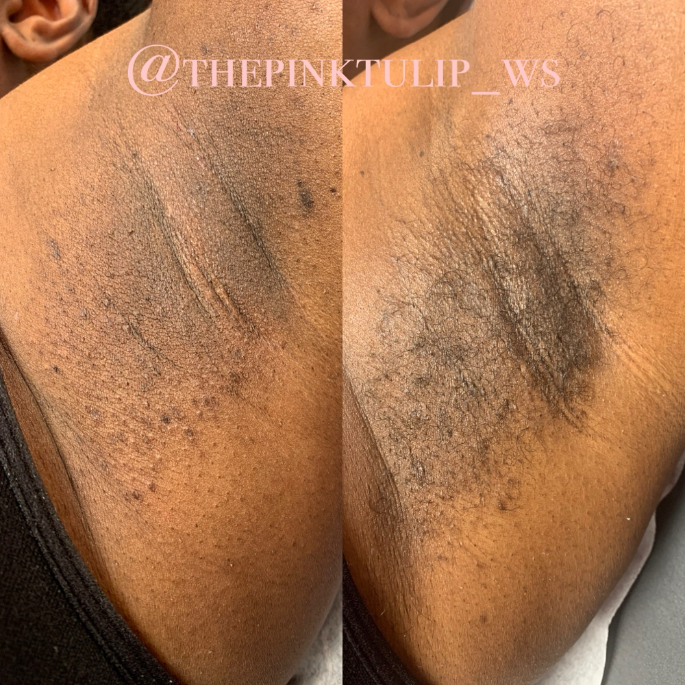 Underarm Wax