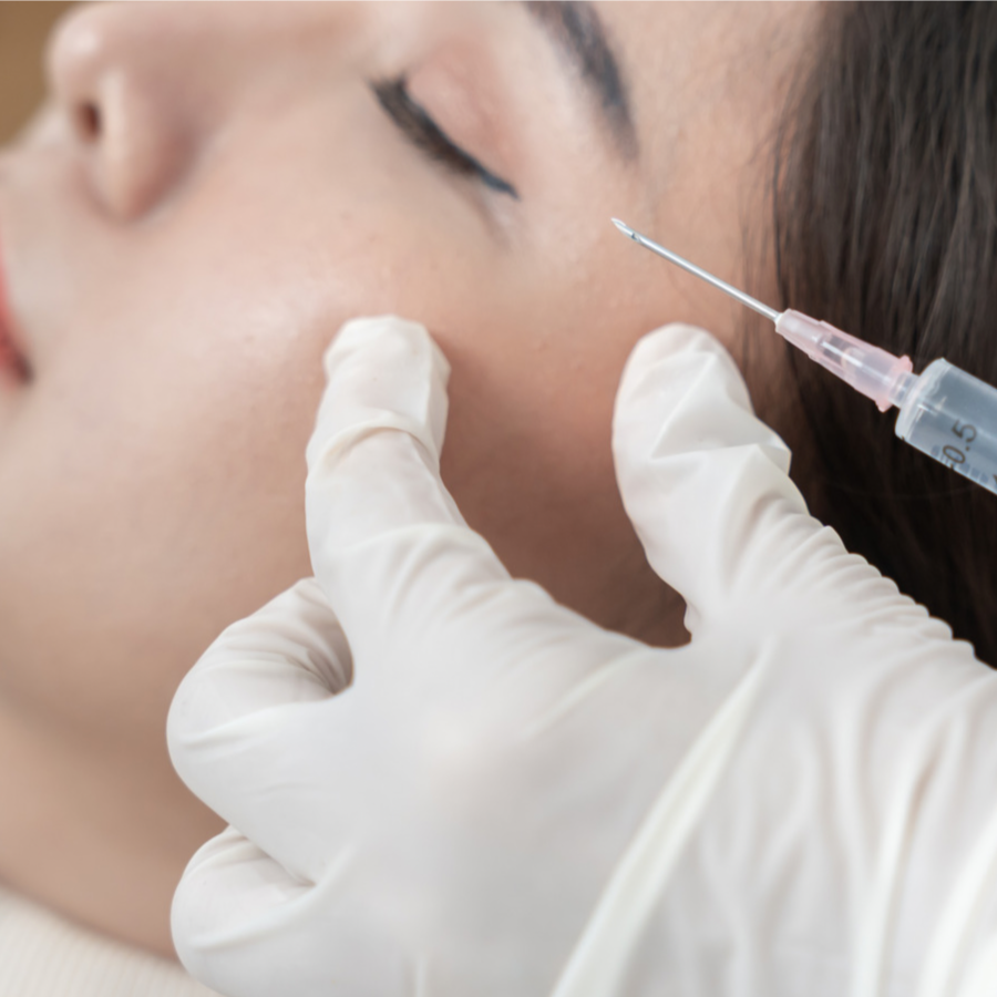 Cheek Filler at Luna Aesthetics in Alexandria, VA