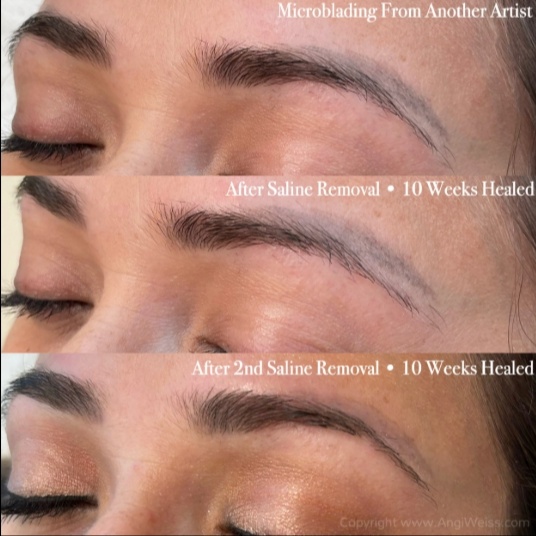 Saline Removal Package at Brows By Amanda Rae in Rockledge, FL