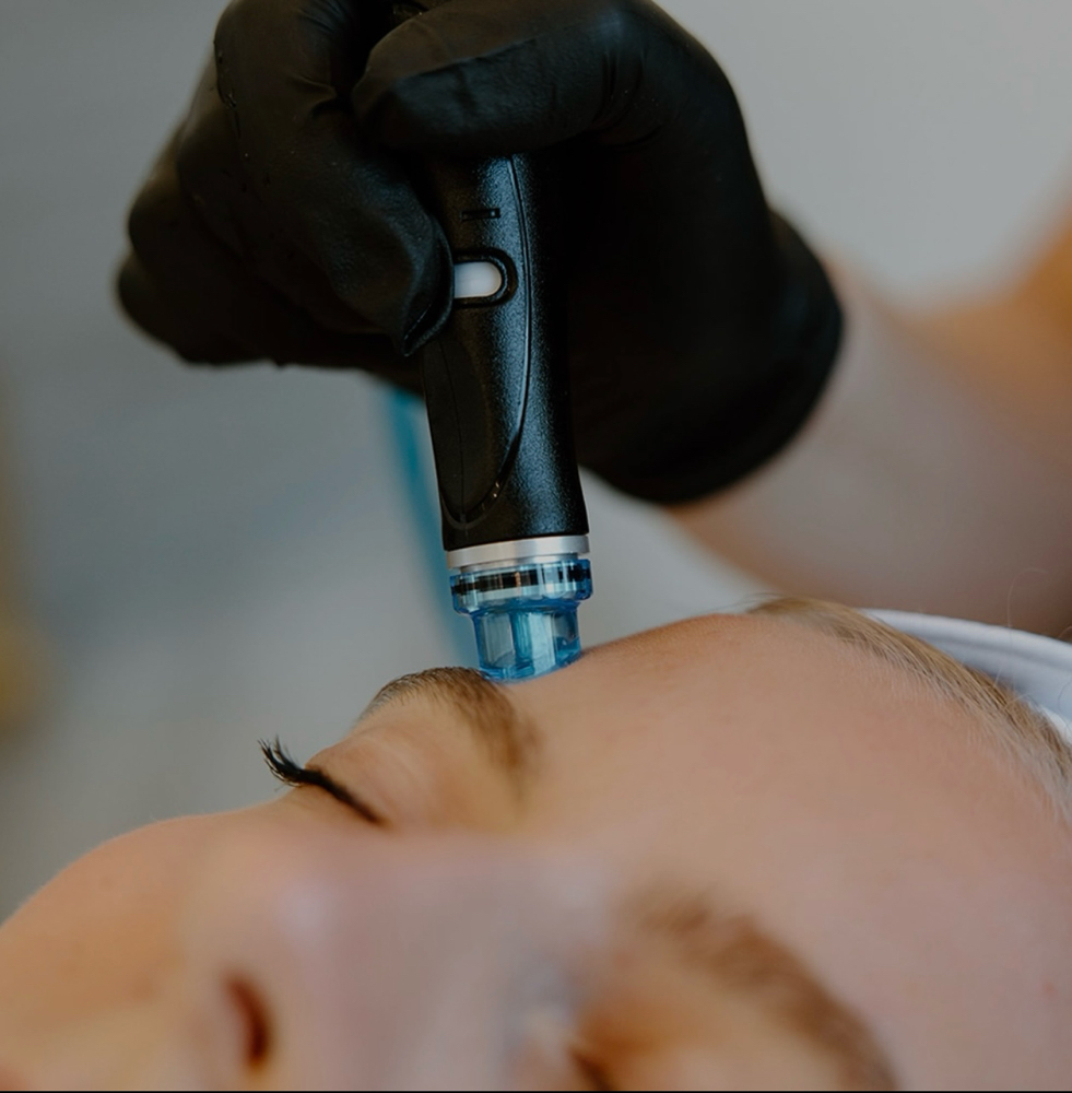 Deluxe HydroFacial