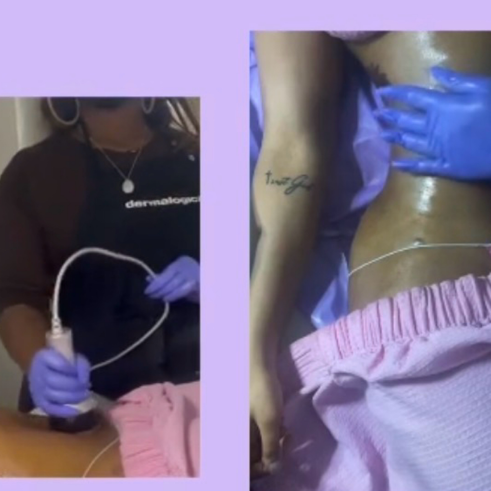 Ultasound Cavitation Treatment at Goddess Glow Esthetics in Houston, TX