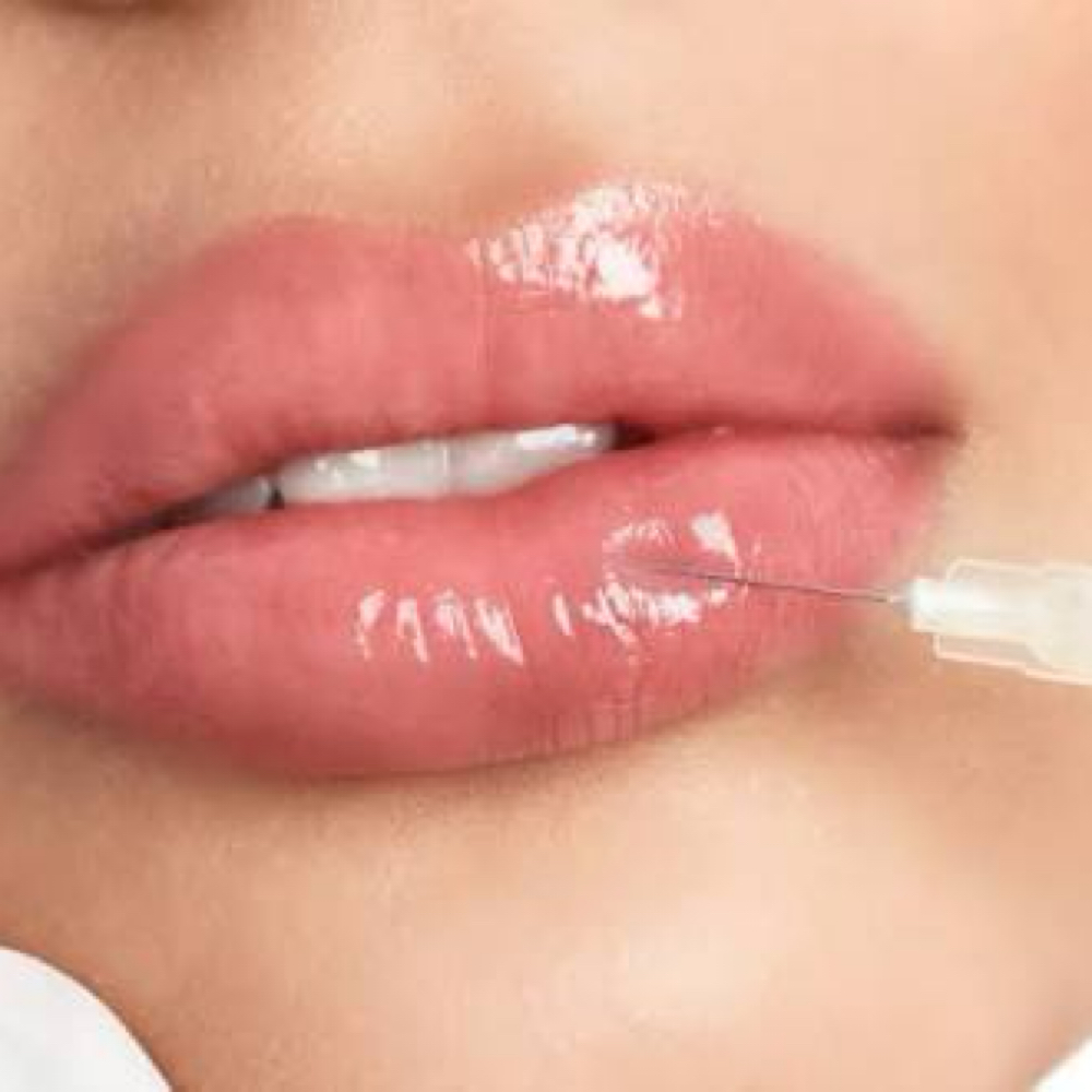 MINI LIP PLUMP FILLER 0.5ml 💋 at Irena Studio & Academy in McAllen, TX