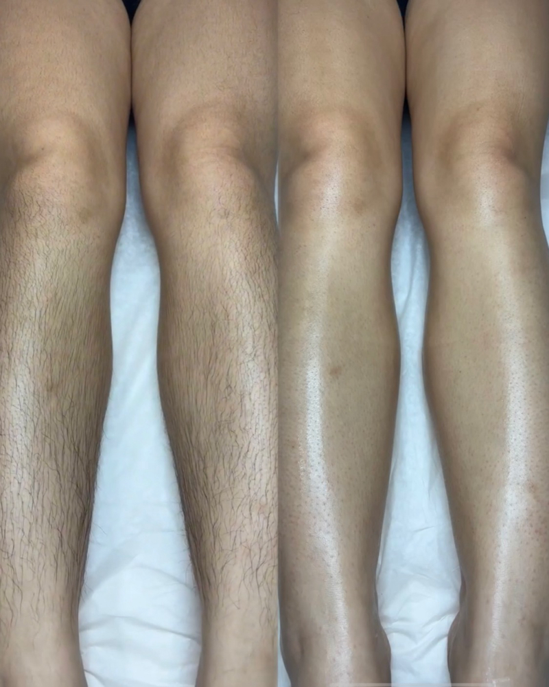 Full Leg Wax