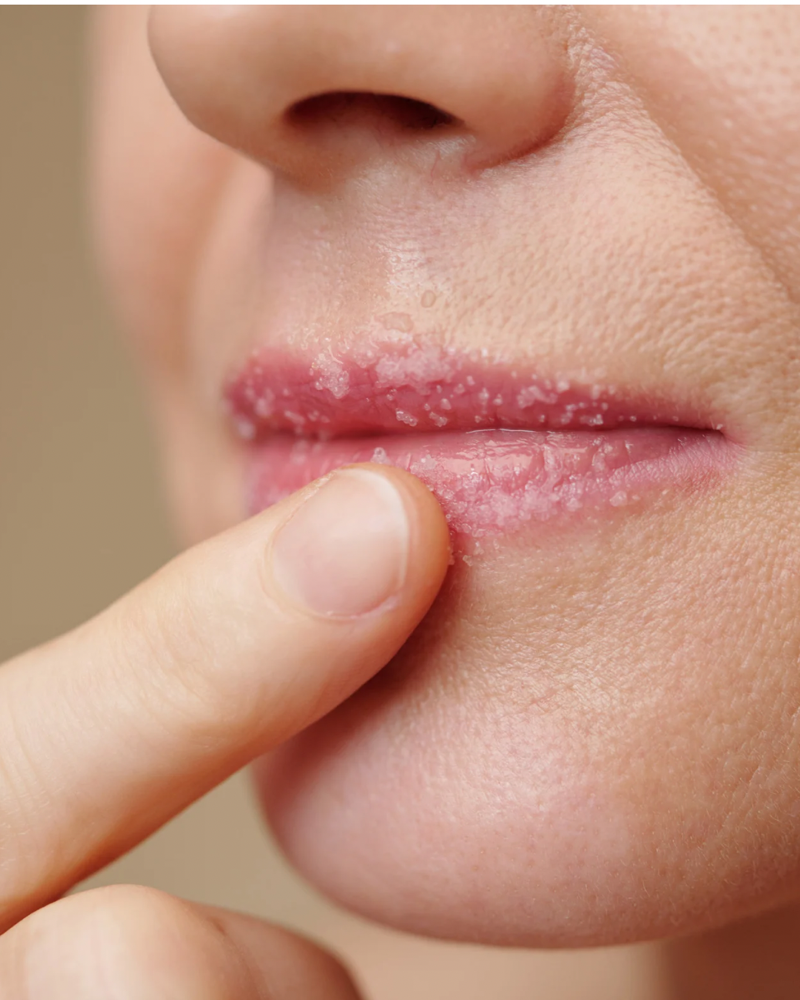 Lip & Chin Laser Hair Removal at M.A.V Aesthetics in Fort Morgan, CO