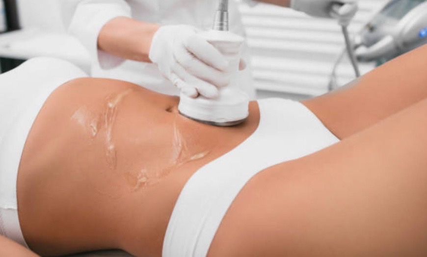 Non-Surgical Lipo Cavitation